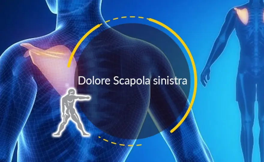 Contrattura scapolare, cosa fare e quando preoccuparsi?
