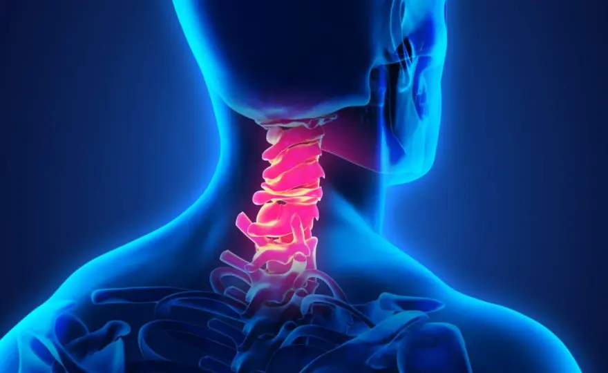 Cervicale, che cos’è davvero e quando preoccuparsi?
