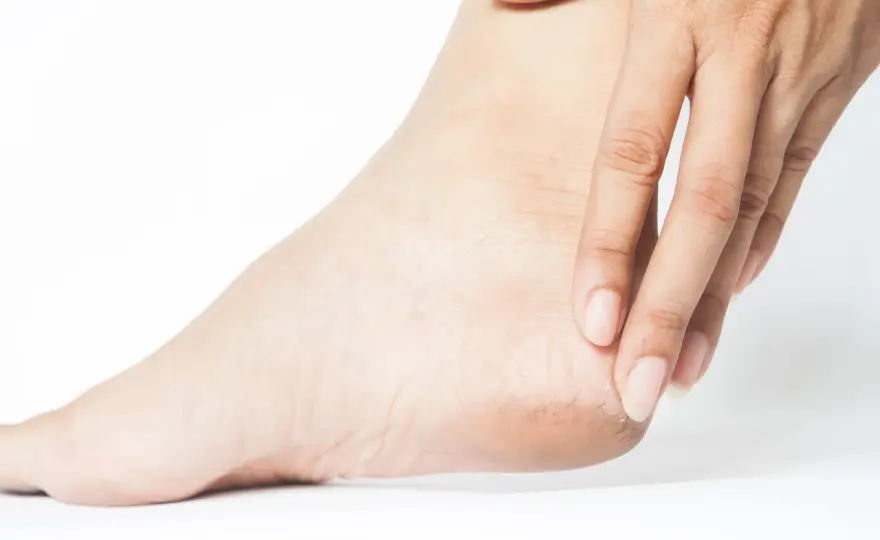Sperone calcaneare e dolore al tallone - cause e rimedi