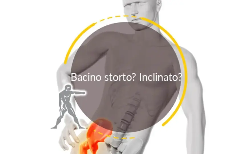 Bacino ruotato e nervi - quando preoccuparsi?