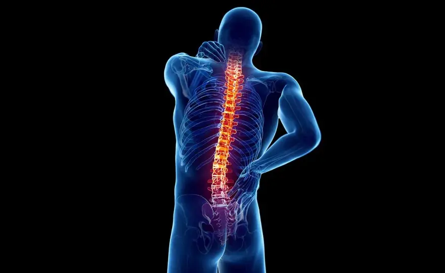 Artrosi interapofisaria, sintomi, diagnosi e cure realistiche