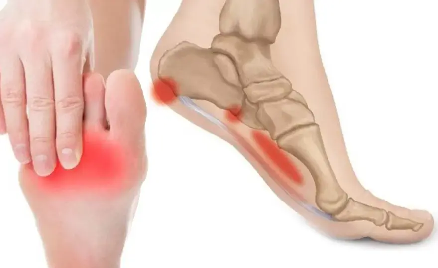 Dolore sotto il tallone? Cause, rimedi ed esercizi