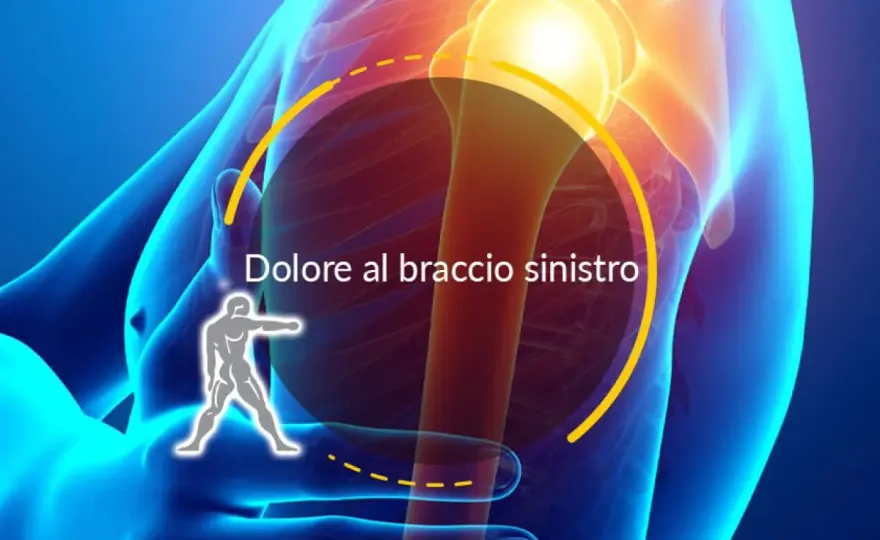 Lesione del tendine del braccio - cosa fare e quando preoccuparsi