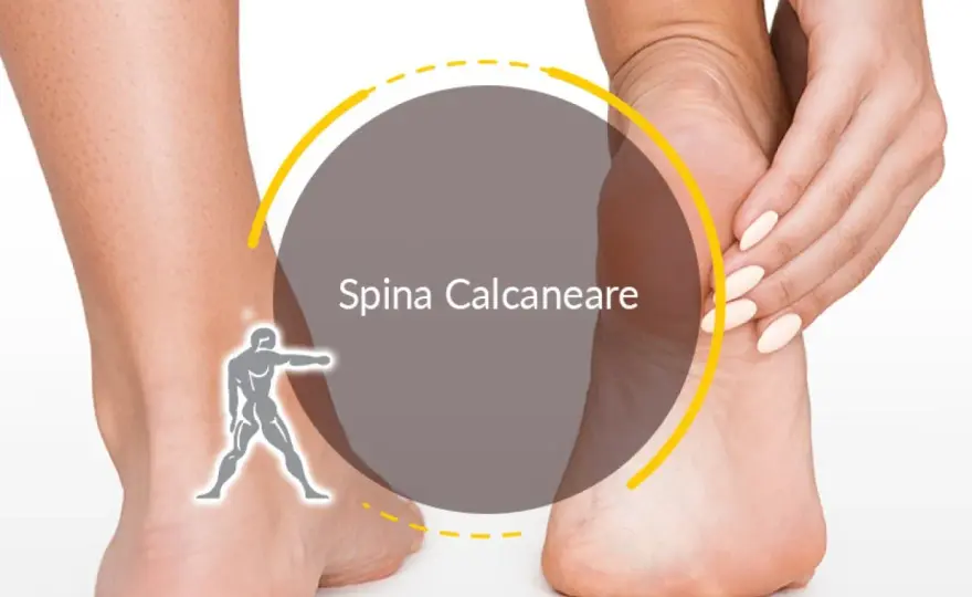 Spina calcaneare, si può camminare? Come gestire il dolore