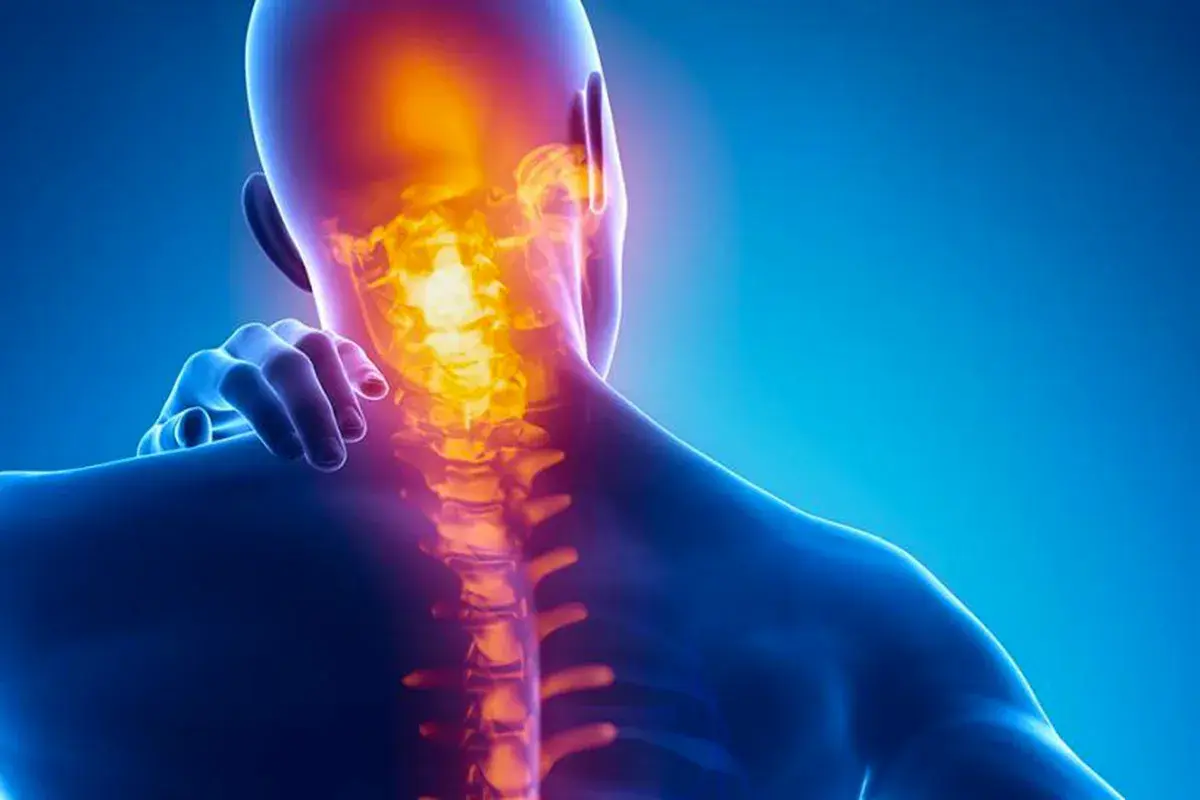 Dolore alla cervicale: un'illustrazione anatomica mostra la colonna vertebrale cervicale illuminata da un bagliore arancione, indicando infiammazione o dolore.