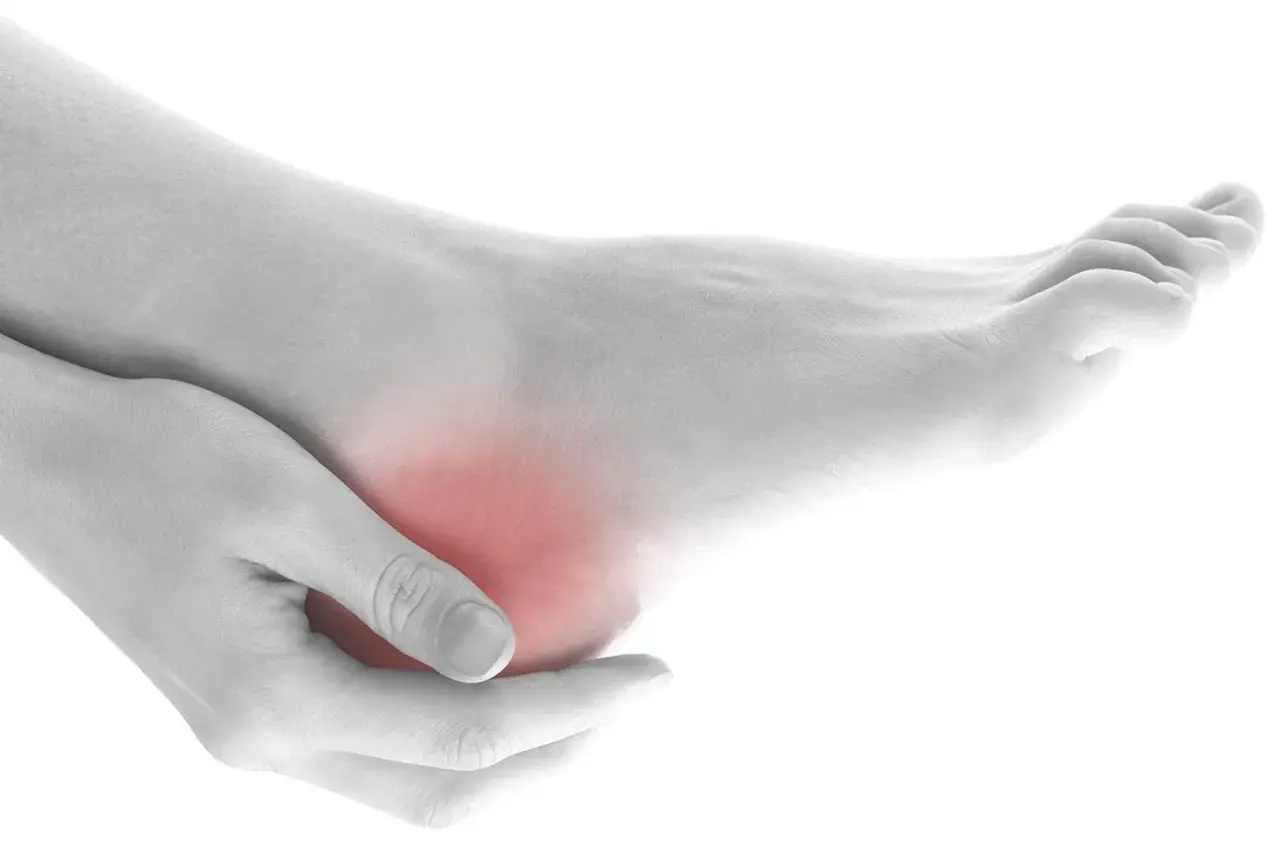 Mano che massaggia un tallone arrossato, indicando dolore ai talloni a letto.