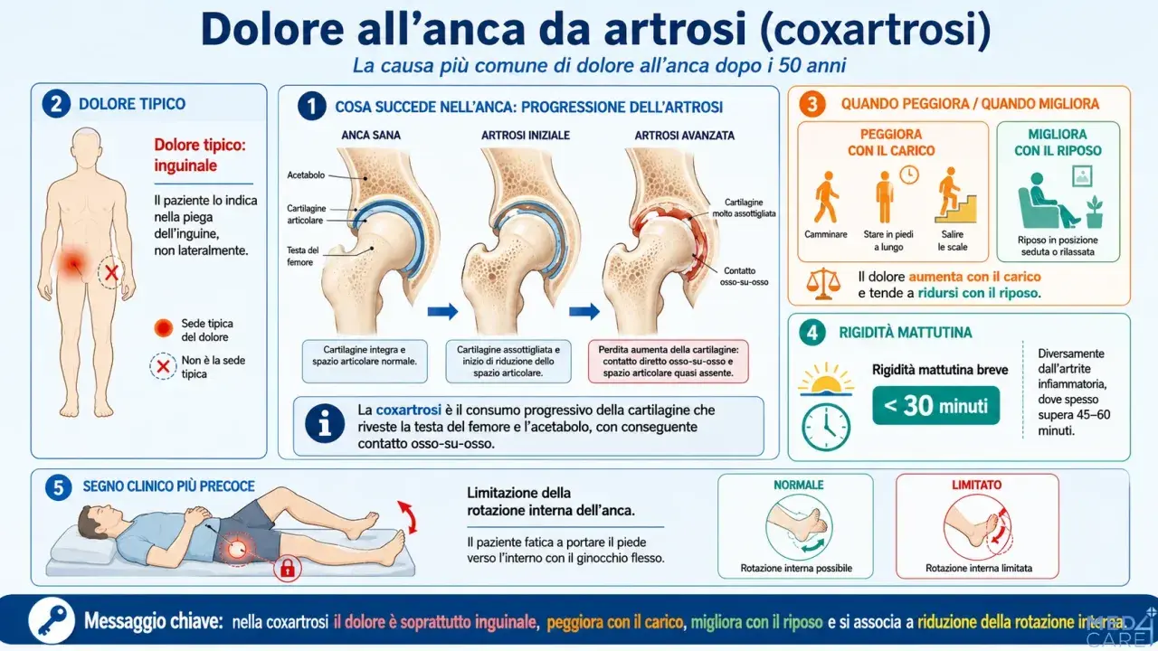 Dolore all'anca da artrosi: la **contusione anca** è tipicamente inguinale, peggiora con il carico e migliora col riposo.