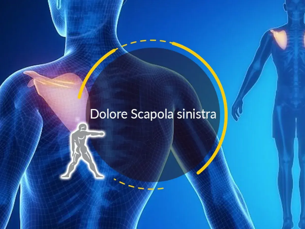 Dolore alla scapola sinistra, forse una contrattura. L'immagine mostra un modello anatomico con enfasi sulla spalla.