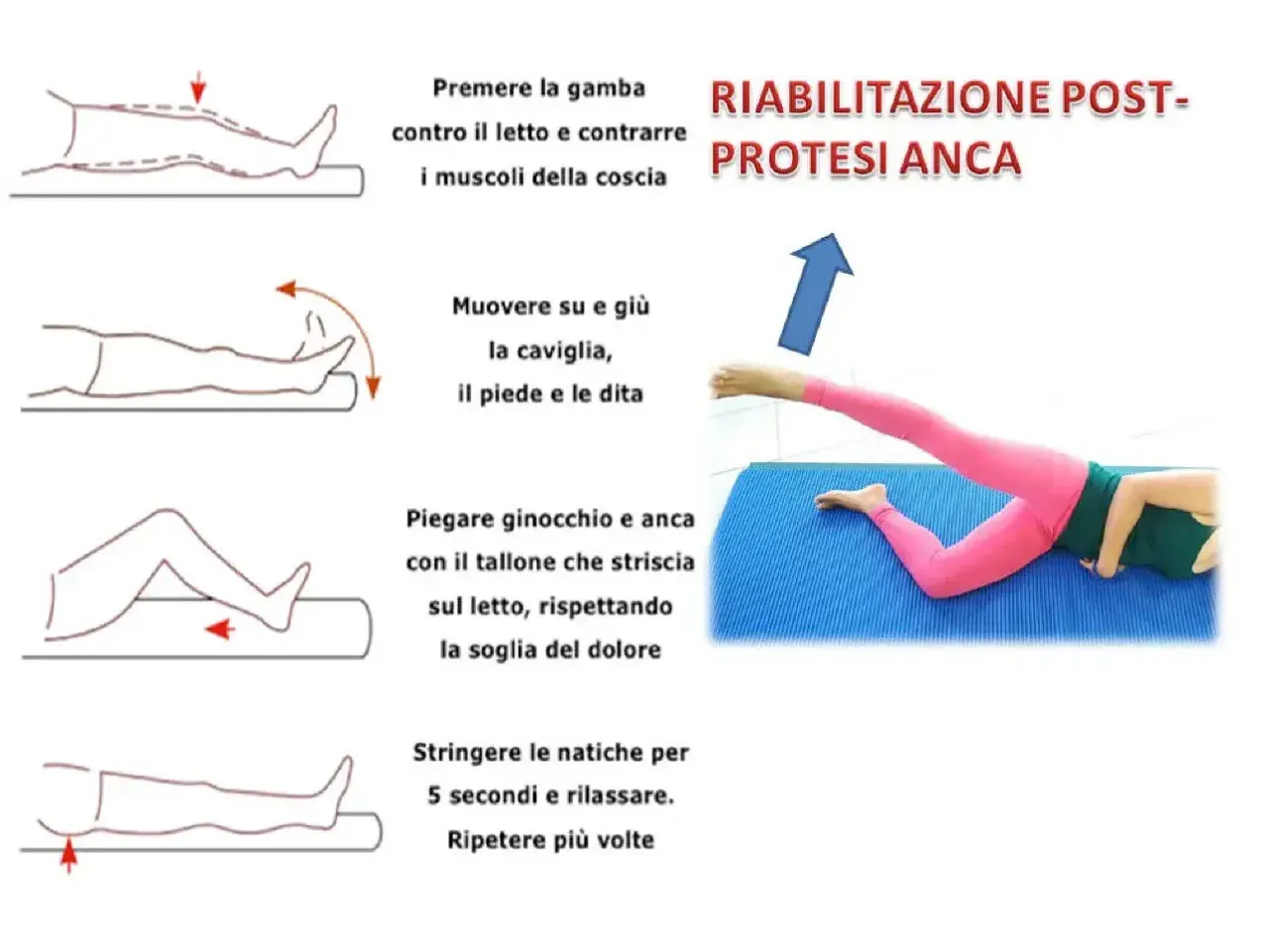 Esercizi per la riabilitazione post protesi anca: contrazione muscoli, mobilità caviglia, piegamenti ginocchio/anca e rinforzo glutei. Tempi di recupero variano.