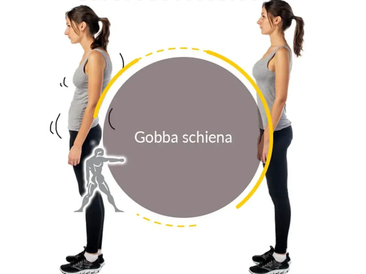 Postura scorretta con gobba schiena e postura corretta. Esercizi per migliorare la schiena.