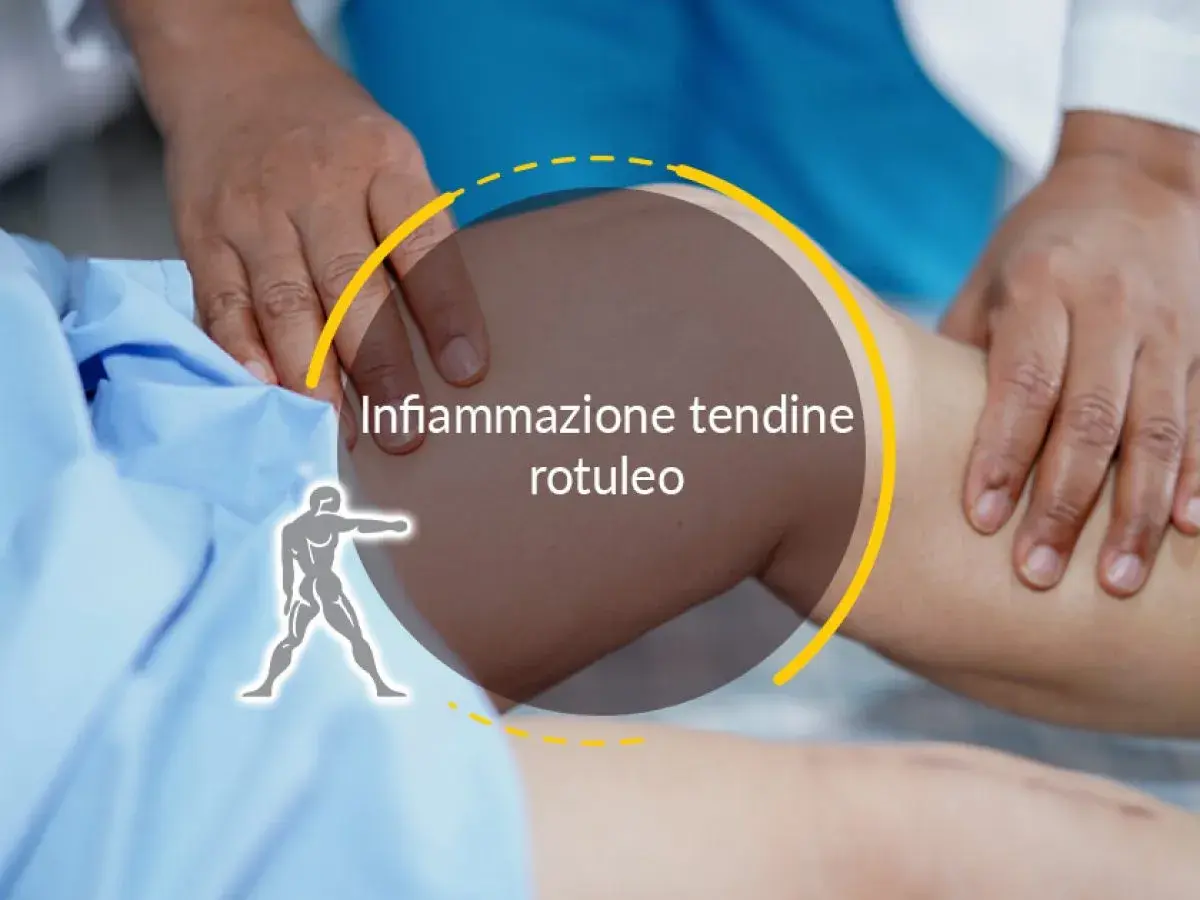 Esame del ginocchio con focus sull'infiammazione del tendine rotuleo. Un medico palpa la zona.