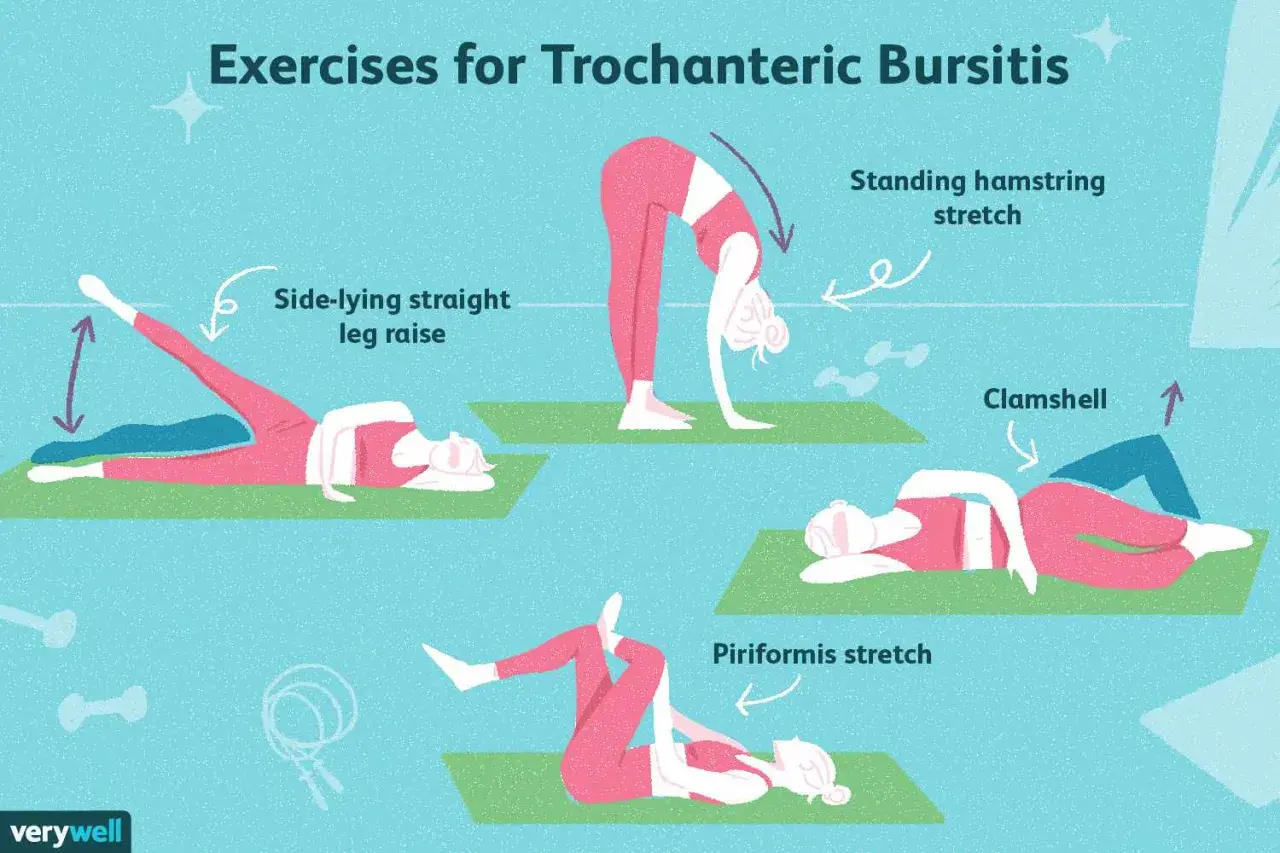 Esercizi per la trocanterite: sollevamento gamba laterale, stretching ischiocrurali, clamshell e piriforme. Rimedi efficaci.