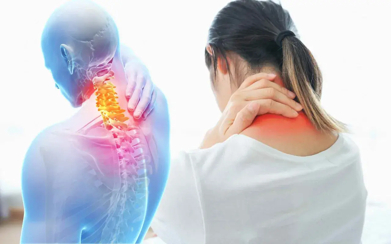 Dolore cervicale che si irradia a gambe e braccia. Anatomia del collo con vertebre evidenziate in giallo e aree di infiammazione in rosso.