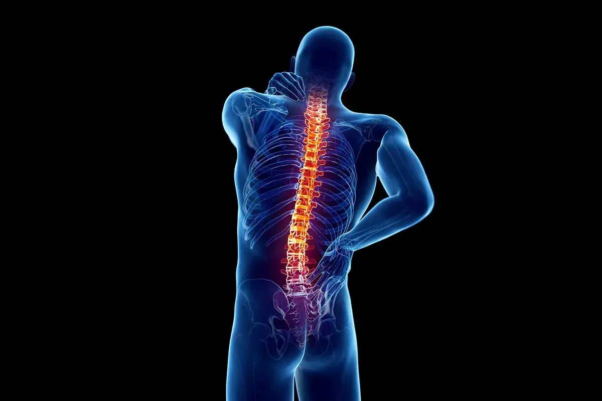 Schiena umana con colonna vertebrale evidenziata in rosso, suggerendo dolore o infiammazione, forse legata all'artrosi interapofisaria.