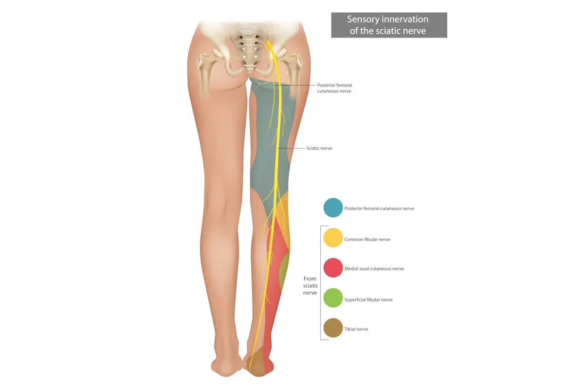 Illustrazione anatomica che mostra chi cura i nervi delle gambe, con il nervo sciatico e le sue ramificazioni.