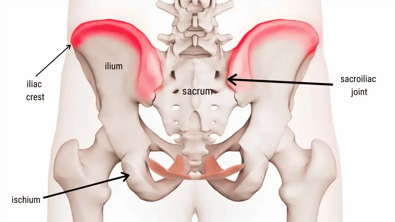 Anatomia del bacino con evidenziato il dolore alla cresta iliaca, sintomi comuni di infiammazione.