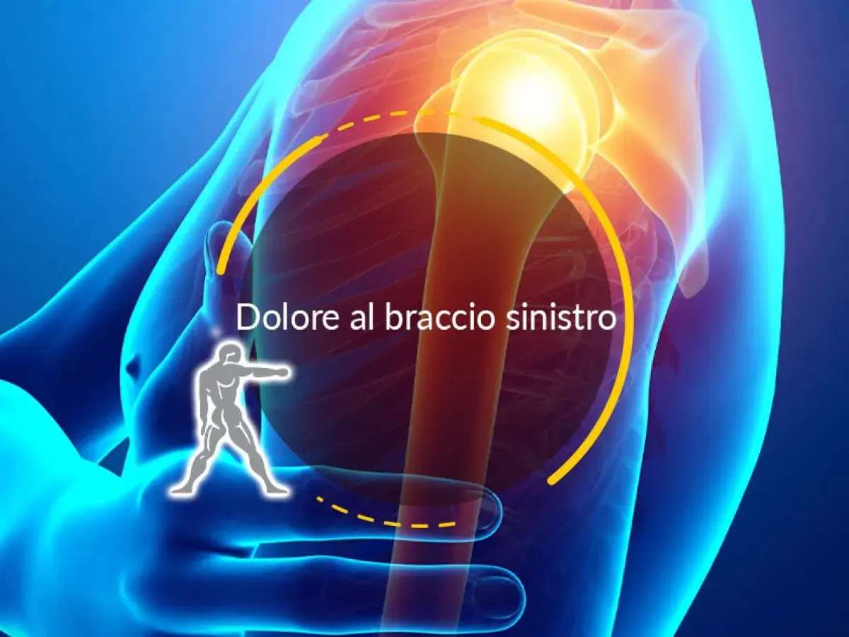 Dolore al braccio sinistro, possibile lesione tendine braccio cosa fare. Focus su spalla e omero.