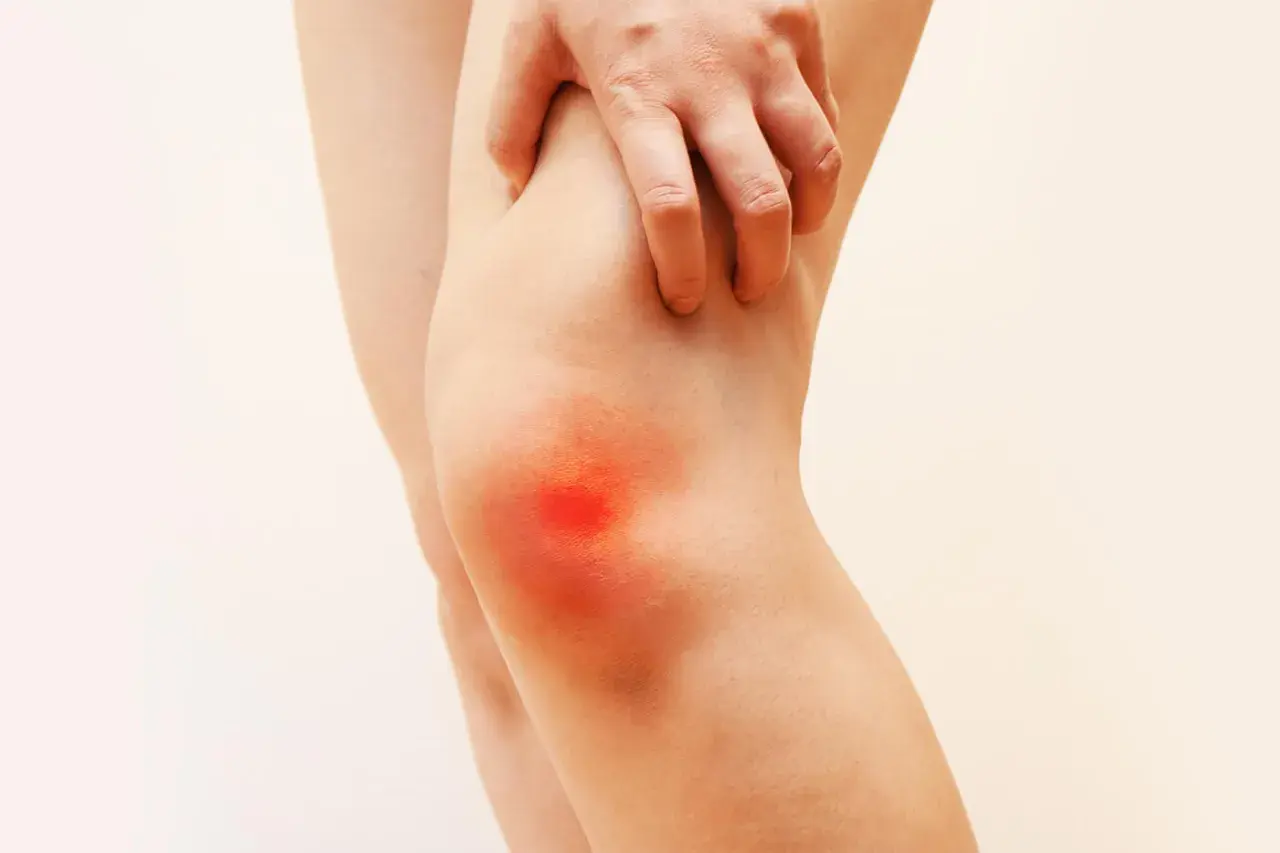 Gonalgia al ginocchio: una mano indica l'area infiammata, suggerendo la ricerca di una cura efficace per il dolore.