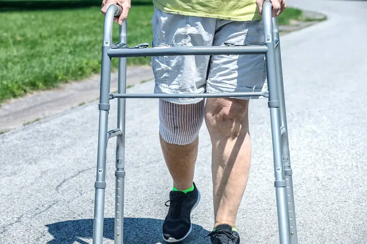 Persona con protesi al ginocchio, che cammina con un deambulatore. I tempi di recupero sono importanti per tornare alla normalità.
