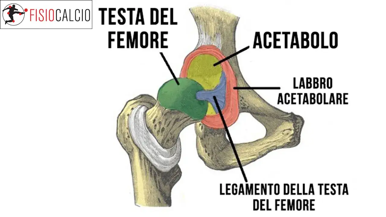Illustrazione anatomica dell'anca che mostra la testa del femore e l'acetabolo, con etichette per il labbro acetabolare e il legamento della testa del femore. Utile per comprendere il conflitto femoro-acetabolare.