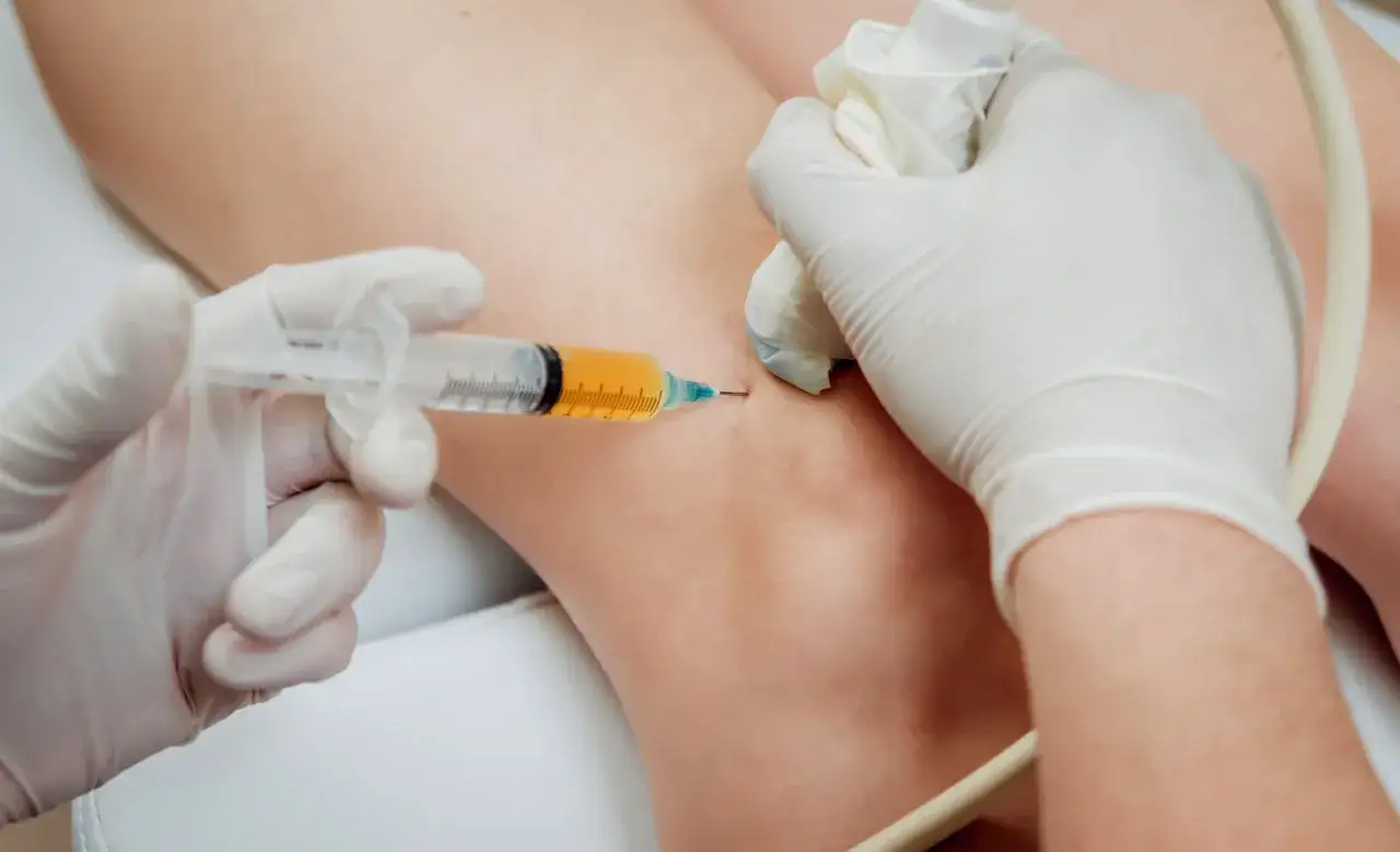 Infiltrazioni al ginocchio con plasma ricco di piastrine per favorire la guarigione.