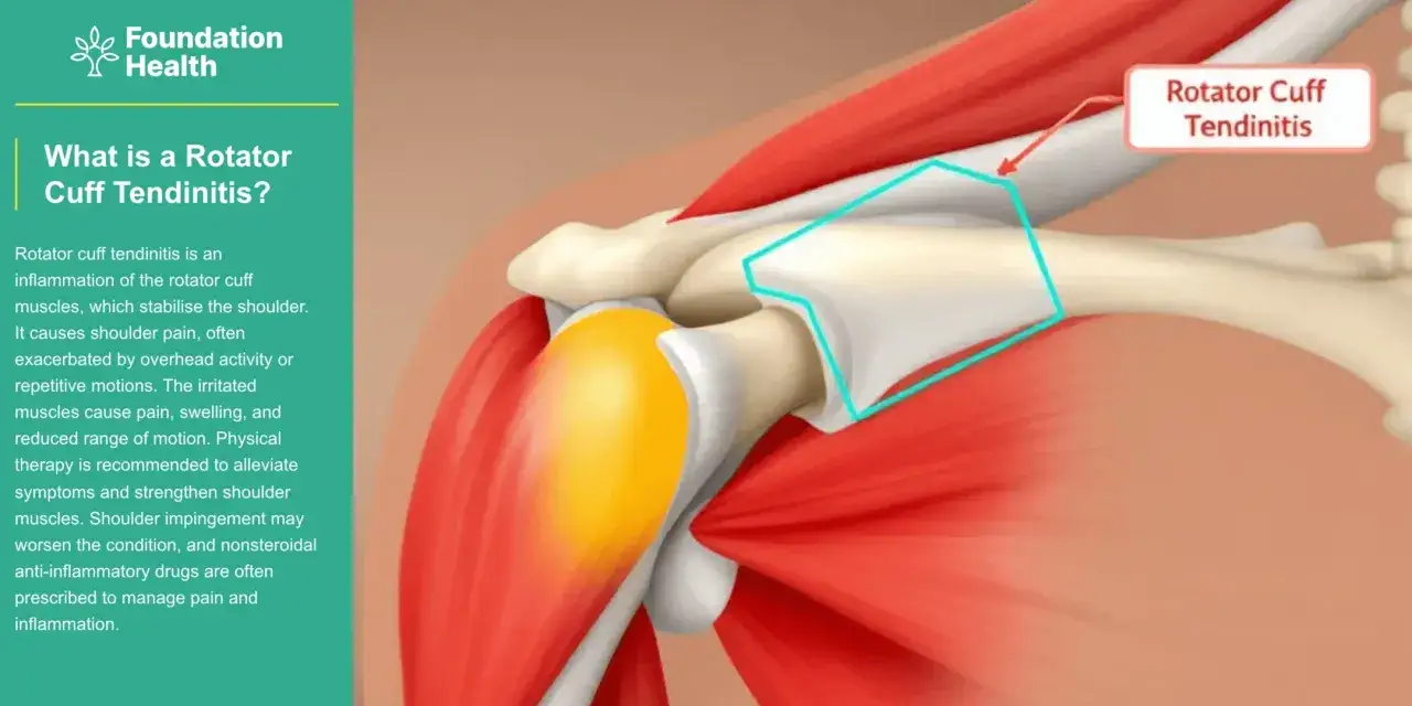 Illustrazione anatomica della spalla che evidenzia la cuffia dei rotatori infiammata, causa di dolore spalla insopportabile.