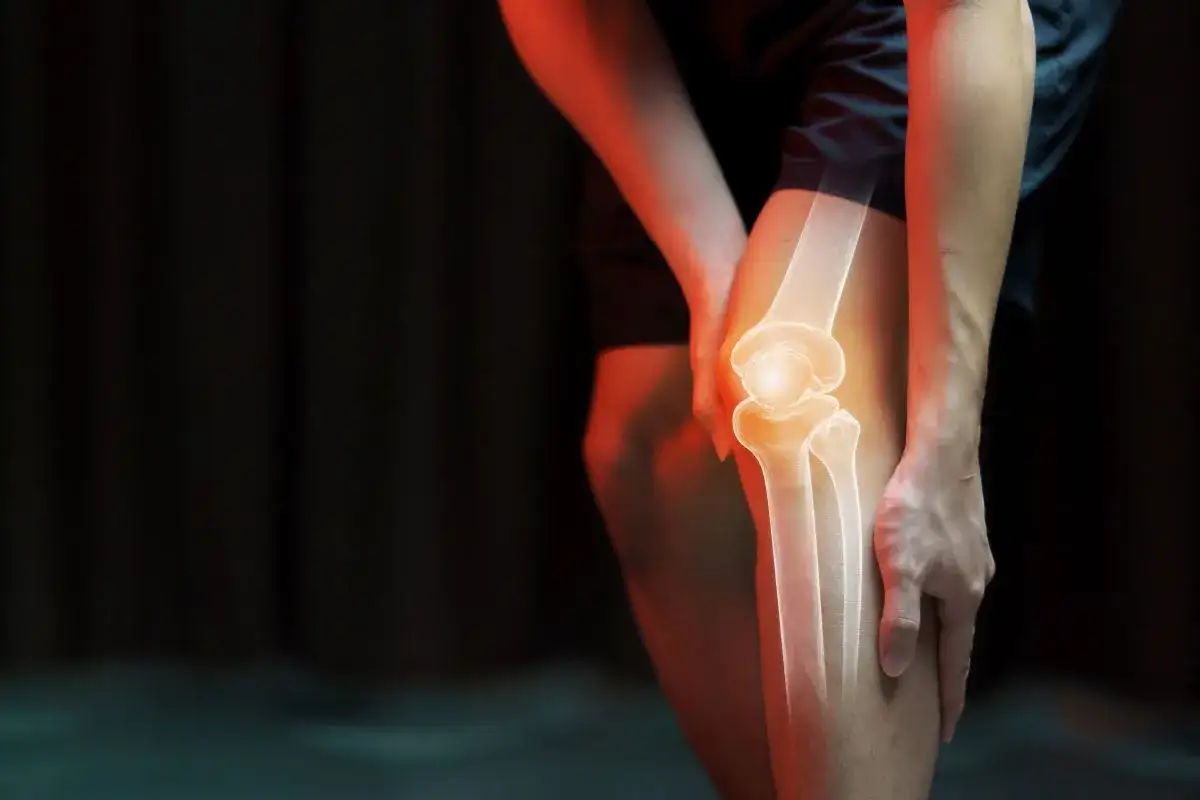 Dolore al ginocchio evidenziato da un'illustrazione scheletrica. Camminare con menisco lesionato è difficile.