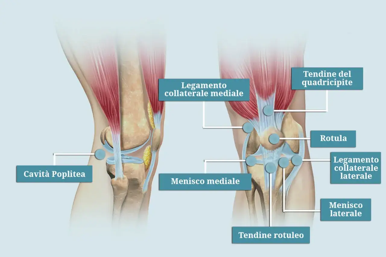 Anatomia del ginocchio con etichette che indicano strutture come il menisco mediale, potenziale causa di bruciore al ginocchio interno.
