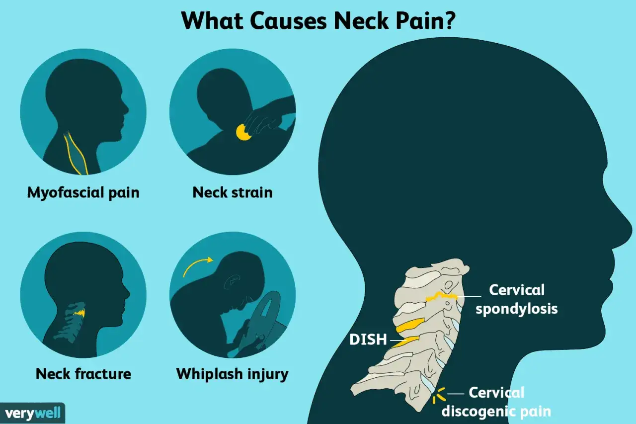 Illustrazione delle cause del dolore ai tendini del collo: dolore miofasciale, torcicollo, frattura, colpo di frusta, spondilosi cervicale, DISH e dolore discogenico cervicale.
